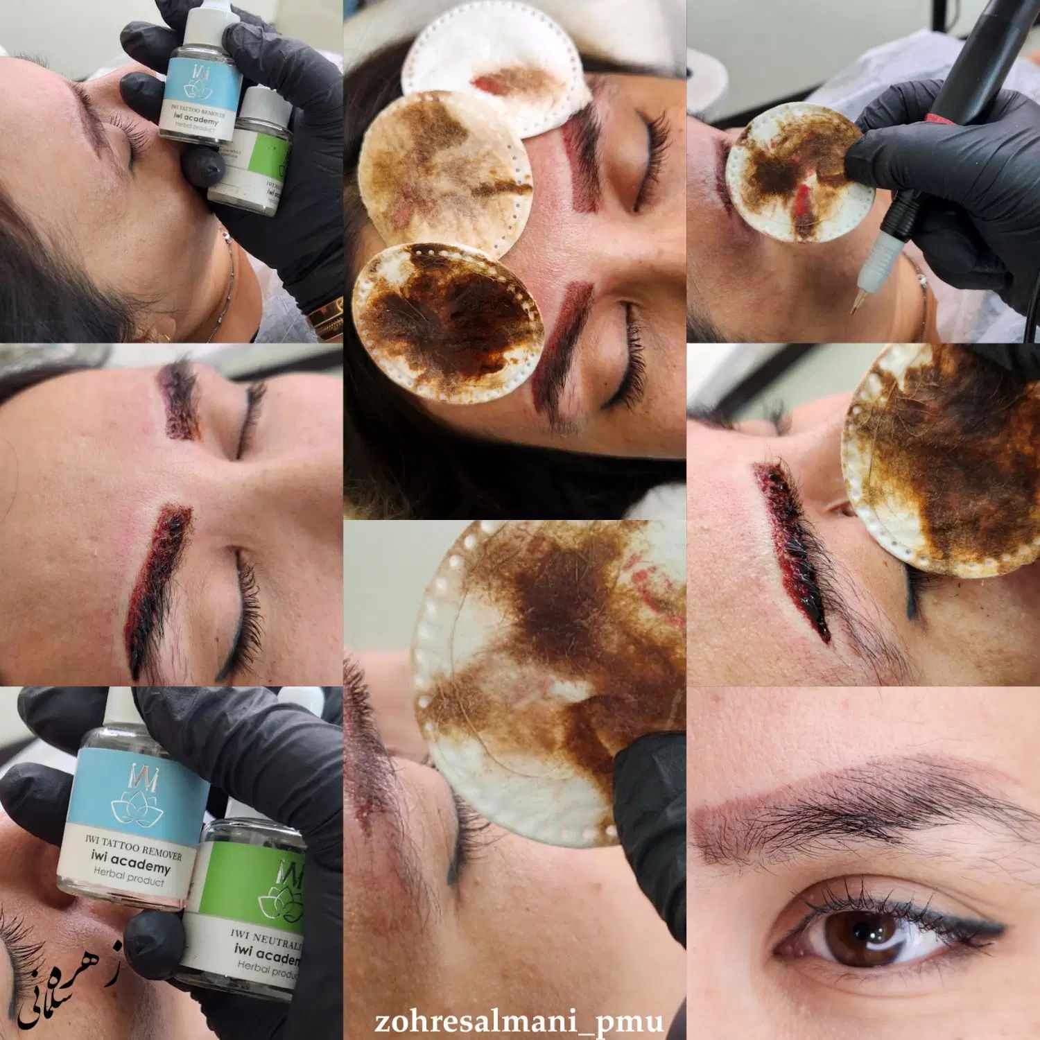 خدمات تخصصی آرایش دائم صورت وپاک کردن تتو|خدمات آرایشگری و زیبایی|تهران, مشیریه|دیوار