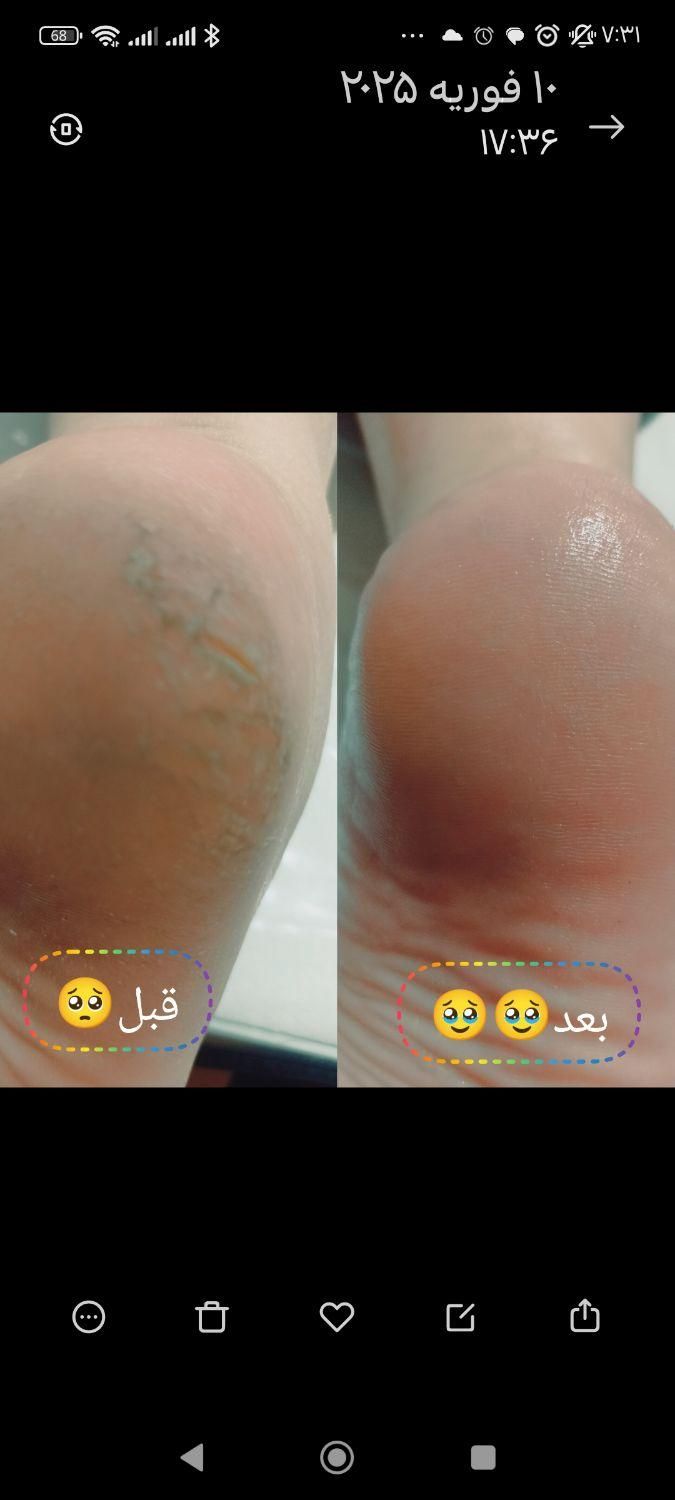 پدیکوریست خاص/ترک/پینه/قوزک|خدمات آرایشگری و زیبایی|قم, سالاریه|دیوار