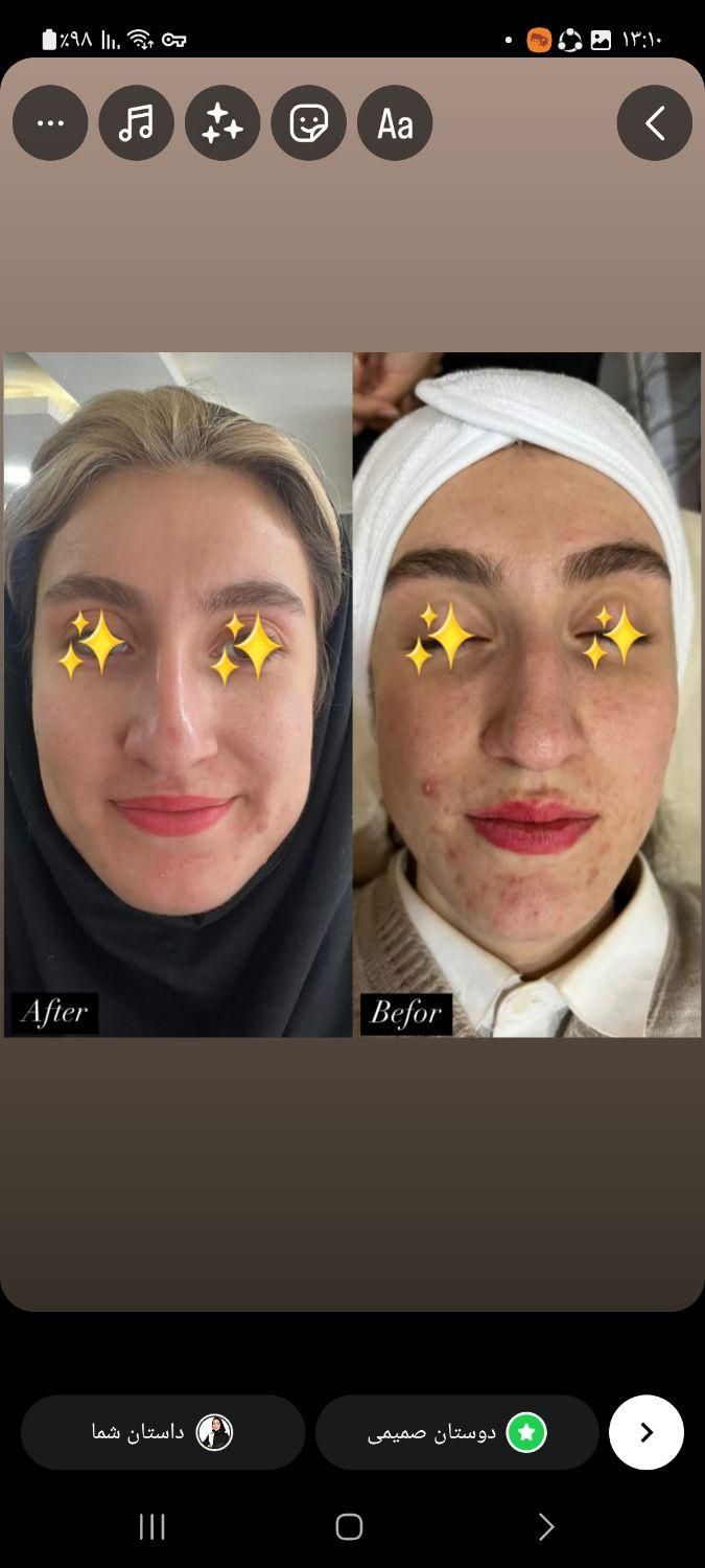 جشنواره فشیال تخصصی با ۵۰٪ تخفیف فقط برای ۵ نفر|خدمات آرایشگری و زیبایی|یزد, |دیوار