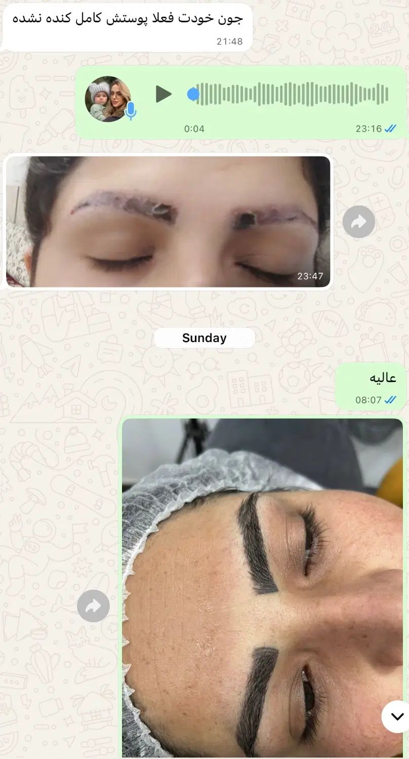 ریموو تاتو های صورت ابرو و چشم و لب در یک جلسه|خدمات آرایشگری و زیبایی|دزفول, |دیوار
