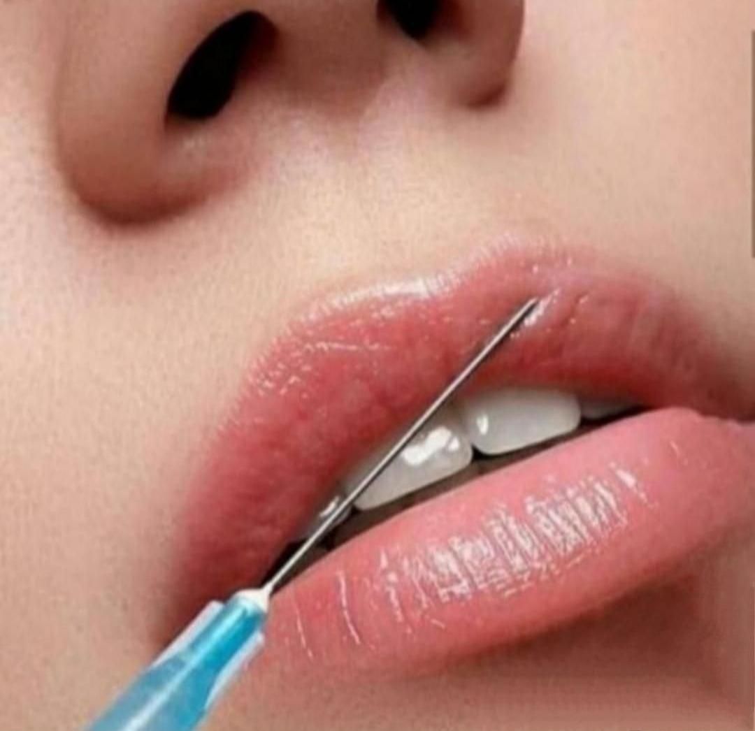 بوتاکس وتزریق ژل لیفت نخ بلفاروساکشن وکاشت مو|خدمات آرایشگری و زیبایی|مشهد, آزادشهر|دیوار