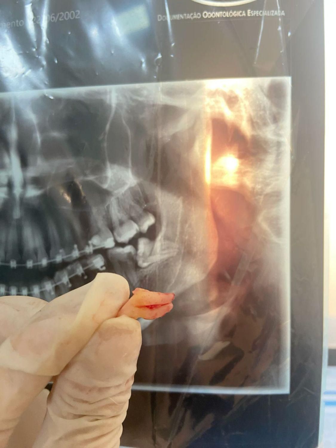 کشیدن با تعرفه خیریه|خدمات آرایشگری و زیبایی|قم, زنبیل آباد|دیوار