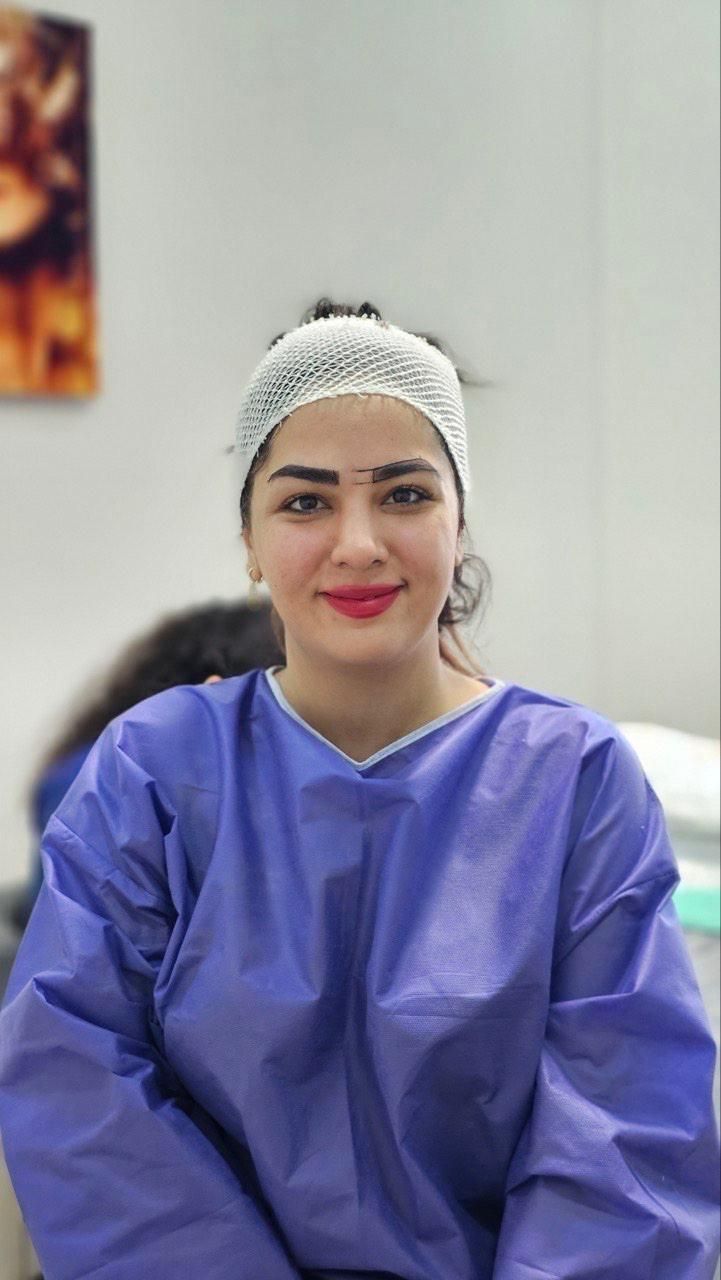 کاشت مو و ابرو و ریش بدون جراحی تراکم بالا|خدمات آرایشگری و زیبایی|تهران, الهیه|دیوار