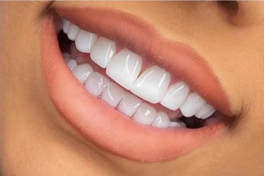 دندانپزشکی و عصب کشی (با تعرفه دولتی بیمه )|خدمات آرایشگری و زیبایی|قدس, شهر‌قدس|دیوار