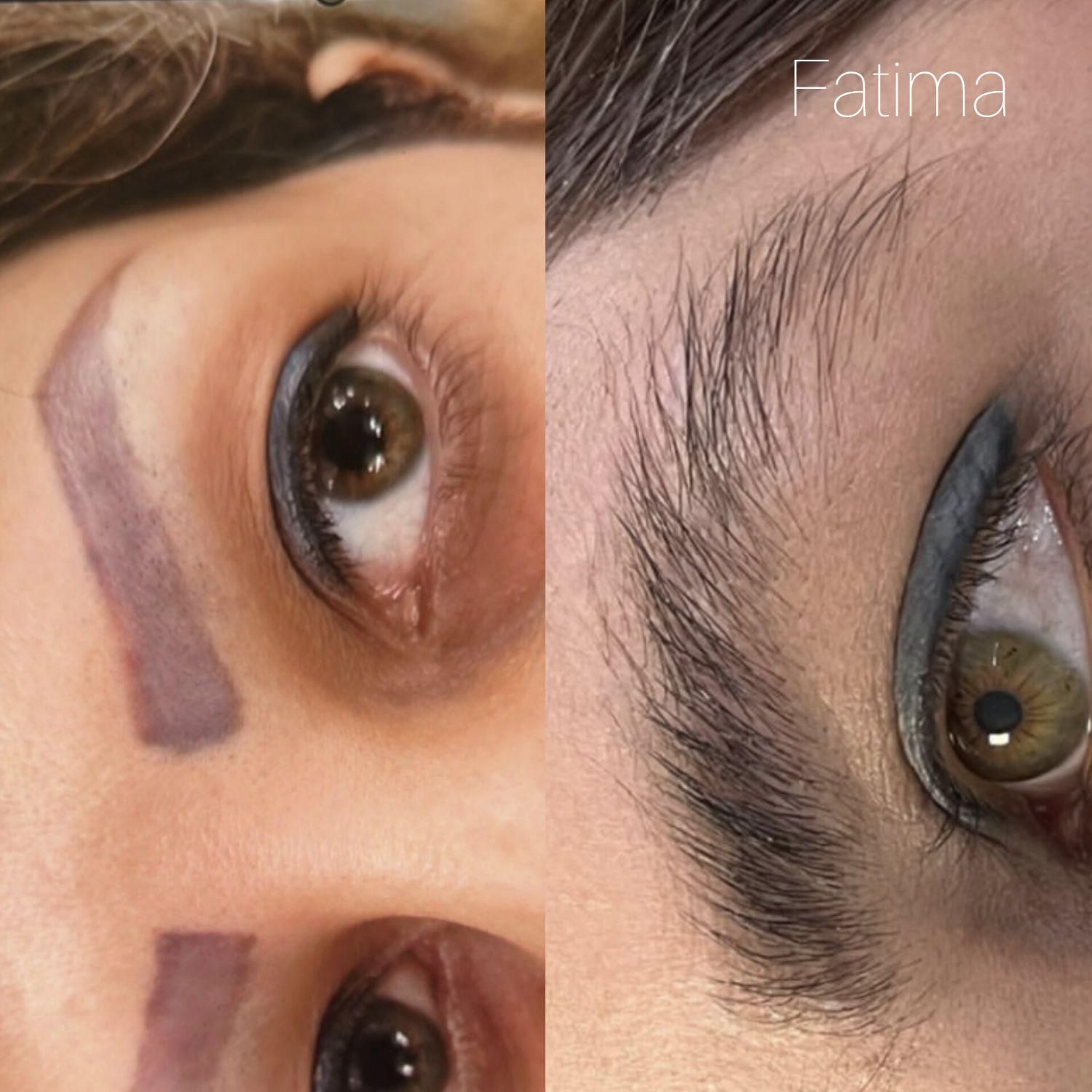 پاک تتوریموو تتو در کیلینیک بدون درد /ریمو ابرو|خدمات آرایشگری و زیبایی|مشهد, آزادشهر|دیوار