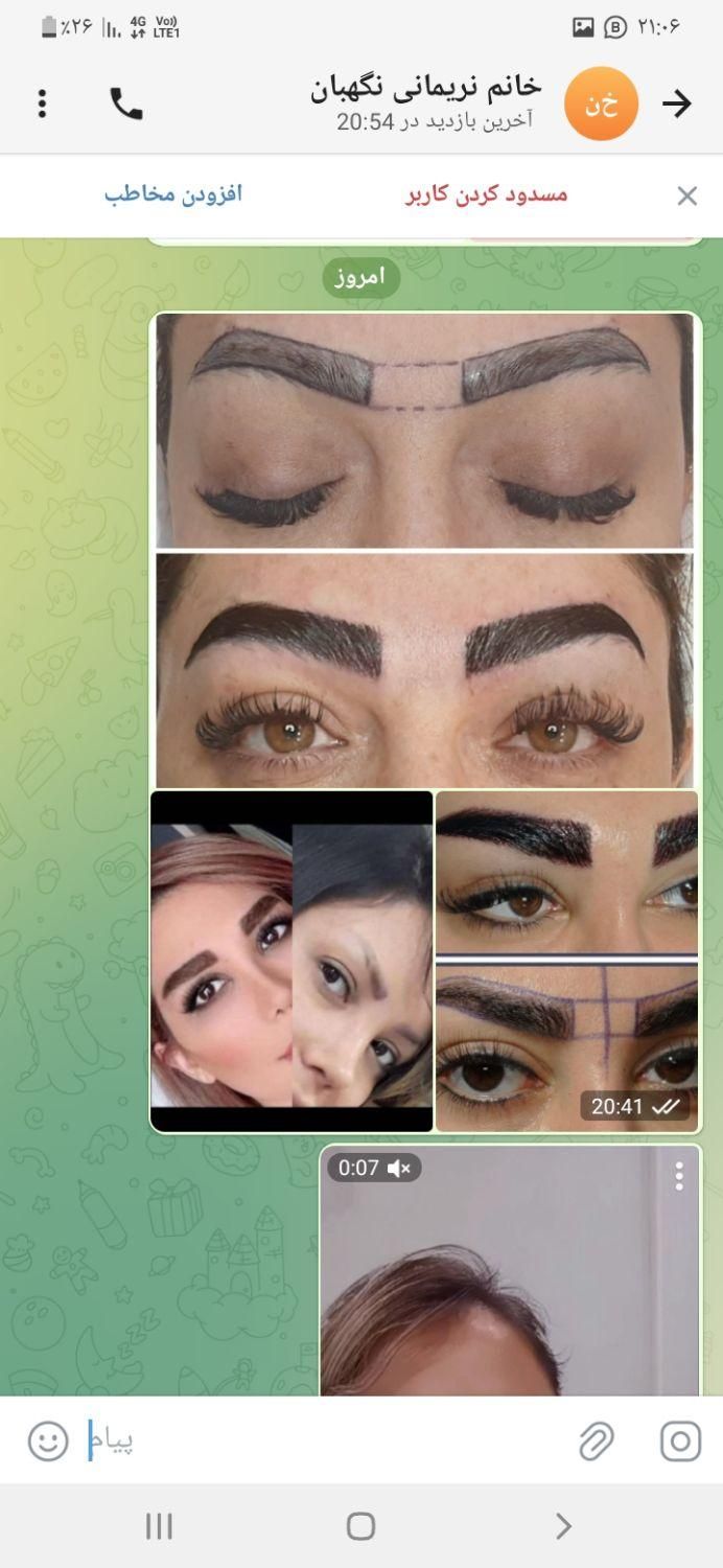 کاشت مو و ابرو|آرایشگاه و سالن‌های زیبایی|تهران, جردن|دیوار