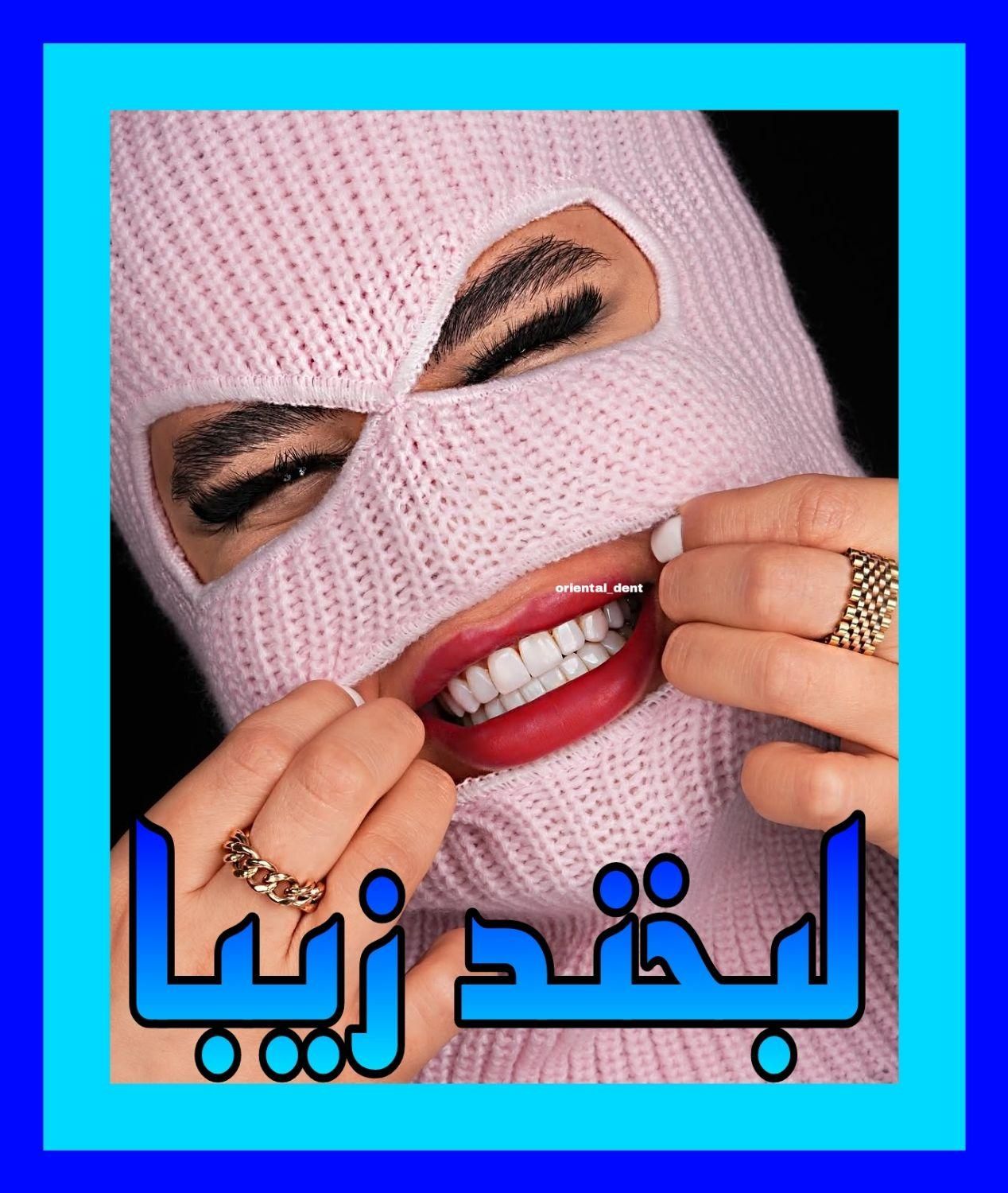 ونیر کامپوزیت ایمپلنت دندان روکش ترمیم و پالیش|خدمات آرایشگری و زیبایی|تهران, میدان ولیعصر|دیوار
