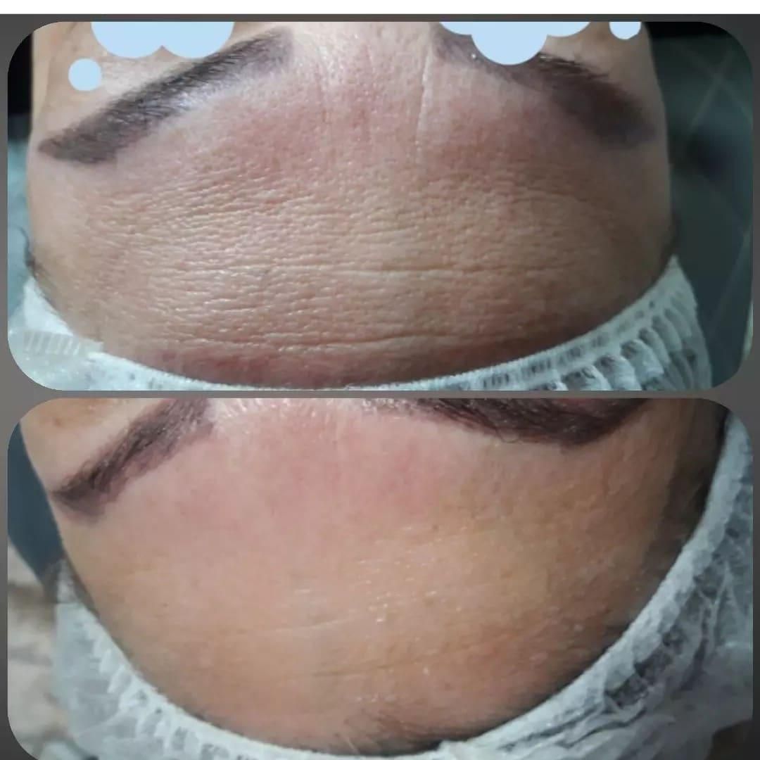 فشیال پاکسازی آموزش تخصصی درمانی همراه مدرک|خدمات آموزشی|تهران, سلسبیل جنوبی|دیوار