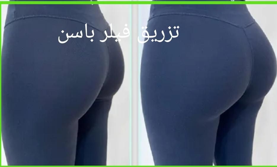 تزریق فیلرهای بدن(دست-مچ پا-باسن)ساکشن غبغپ|خدمات آرایشگری و زیبایی|اصفهان, ملک‌شهر|دیوار