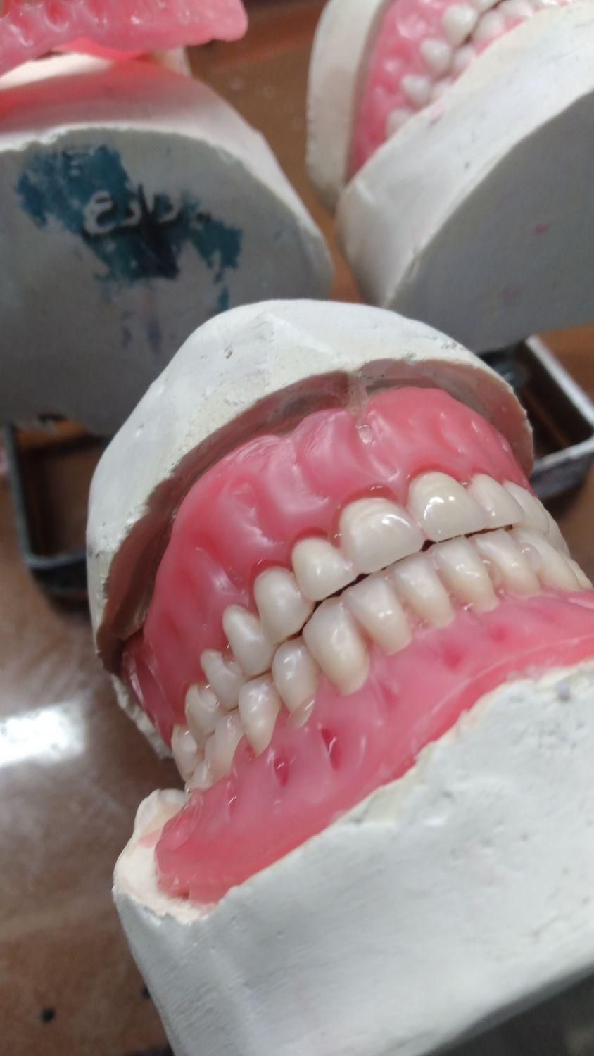 ساخت انواع دندان مصنوعی ژله‌ای آلمانی|خدمات آرایشگری و زیبایی|کرج, آزادگان|دیوار