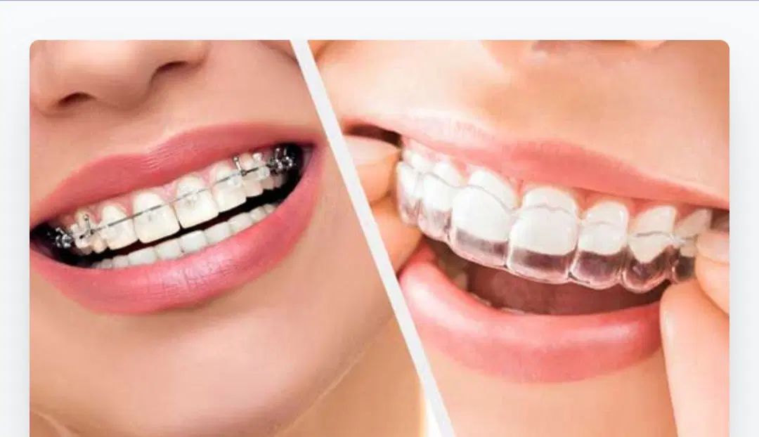 دندانپزشکی تخصصی ارتودنسی(مرتب کردن دندان ها) قسطی|خدمات آرایشگری و زیبایی|اهواز, شهرک حفاری|دیوار