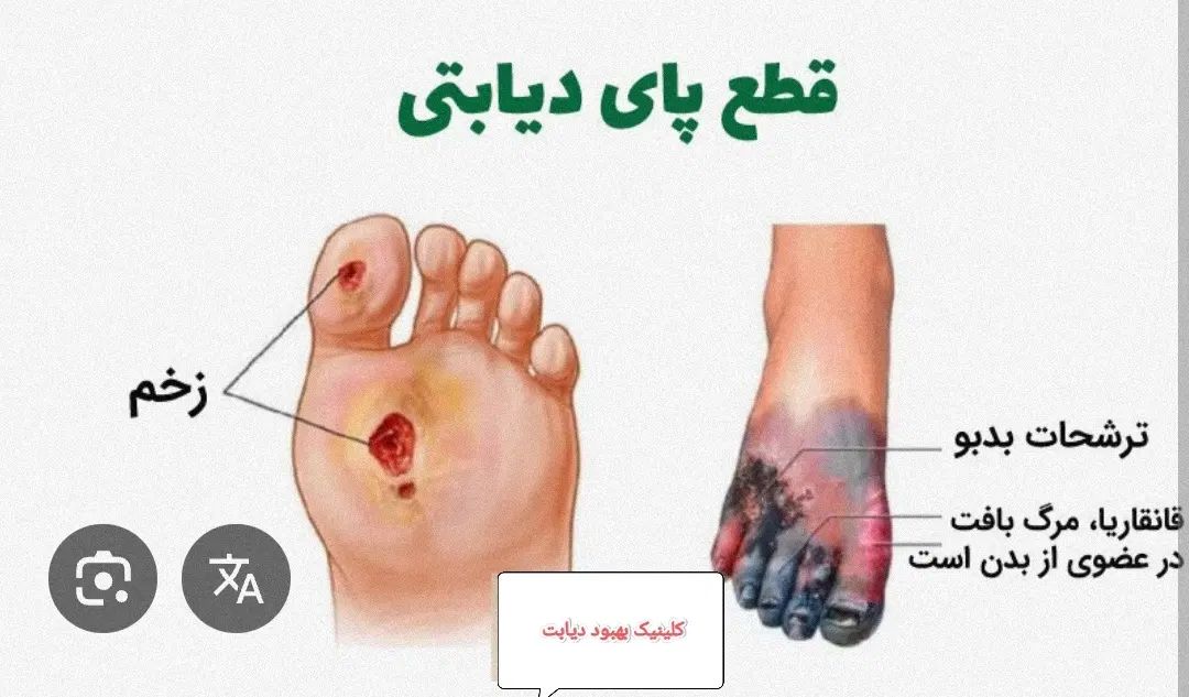 دیابت درمان شد(یک هفته ای قندتو بیار زیر ۱۰۰)|خدمات آرایشگری و زیبایی|مشهد, هفده شهریور|دیوار