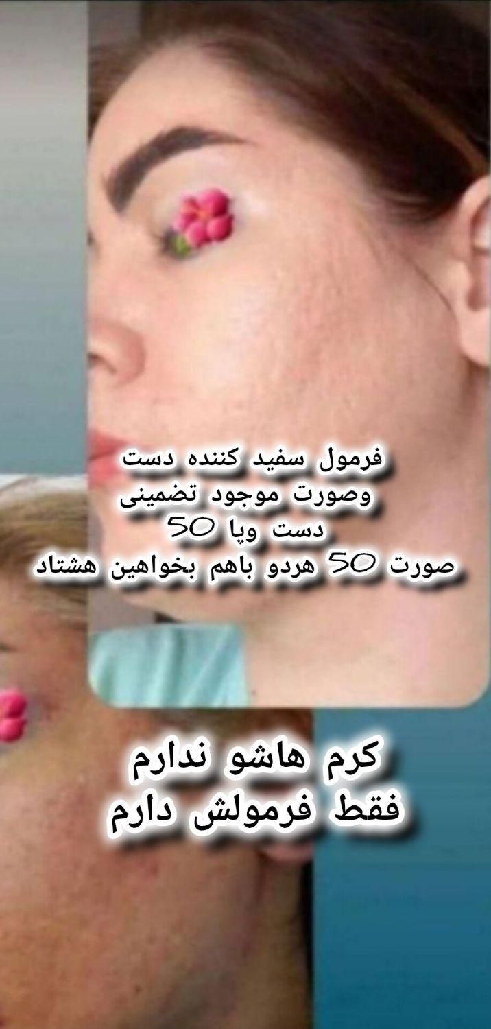 گوشی|موبایل|سراوان, |دیوار