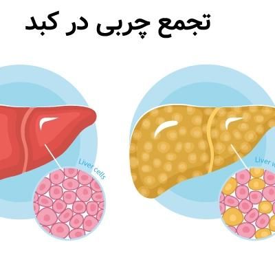 روغن خوراکی برای رفع کبد چرب|خوردنی و آشامیدنی|تهران, میدان انقلاب|دیوار