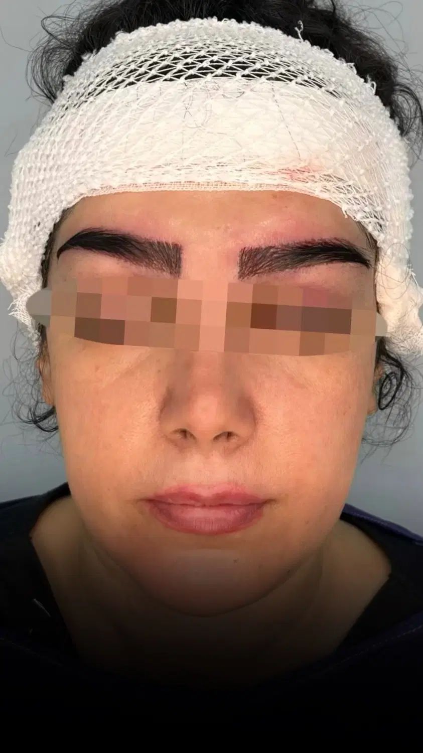 مدل کاشت ابرو(تعداد محدود)|خدمات آرایشگری و زیبایی|رشت, بوسار|دیوار