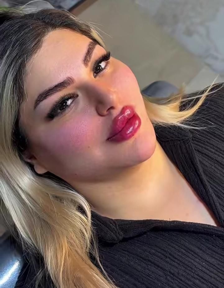 تزریق ژل،بوتاکس،فیلر،مزوتراپی،پی آر پی هایفو|خدمات آرایشگری و زیبایی|اردبیل, |دیوار