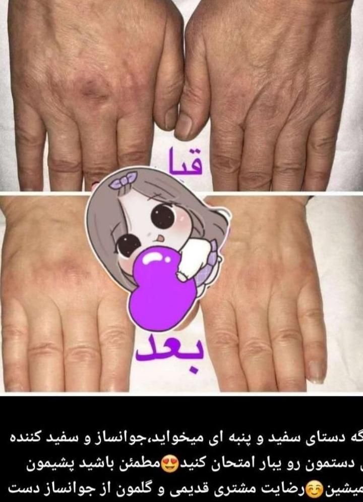 با من دیگه هیچ وقت پیر نمیشی|آرایشی، بهداشتی، درمانی|رشت, منظریه|دیوار