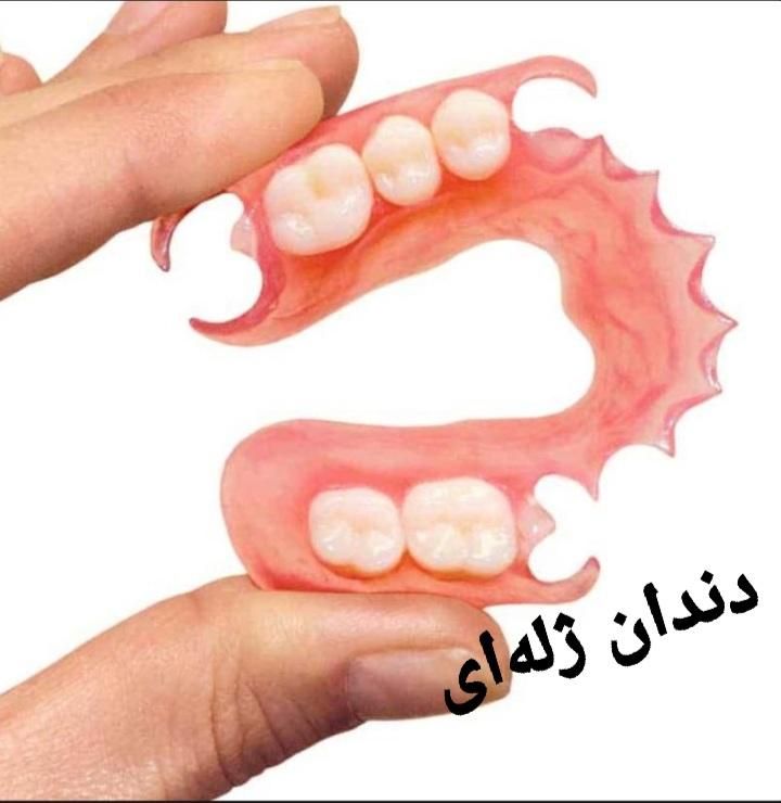 ‌دندان ژله‌ای آلمانی طرح لمینت دست دندان کامپوزیتی|خدمات آرایشگری و زیبایی|کرج, مصباح|دیوار
