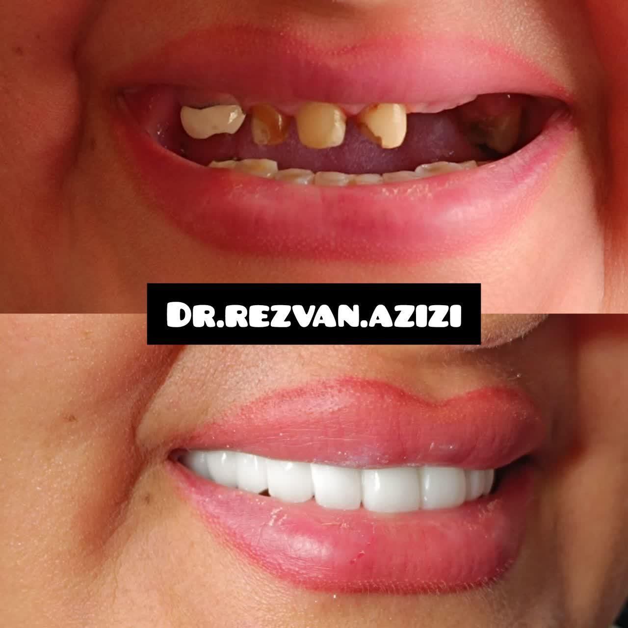 طرح لبخند، کامپویت تخصصی،اقساط،دندانپزشکی زیرتعرفه|خدمات آرایشگری و زیبایی|شیراز, قصرالدشت|دیوار