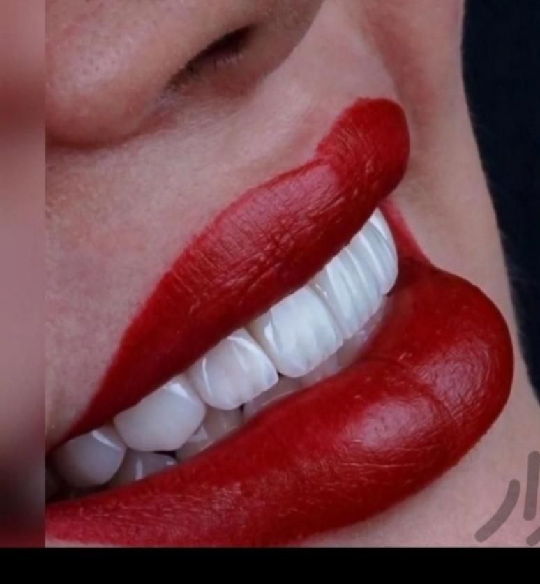 دندان مصنوعی|خدمات آرایشگری و زیبایی|اردبیل, |دیوار