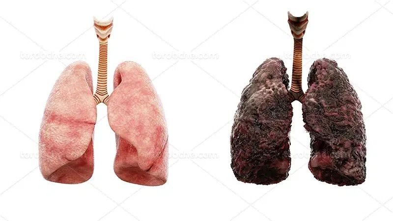 سرفه ،تنگی نفس یا عفونت ریه داری|آرایشی، بهداشتی، درمانی|تهران, اقدسیه|دیوار