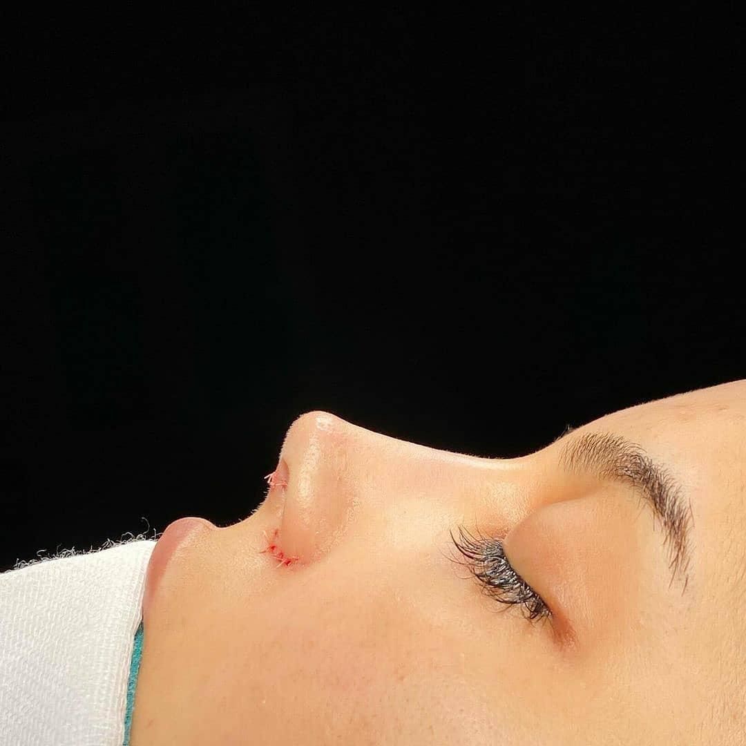عمل جراحی زیبایی بینی،لیفت صورت،گوش|خدمات آرایشگری و زیبایی|تهران, تهرانپارس غربی|دیوار