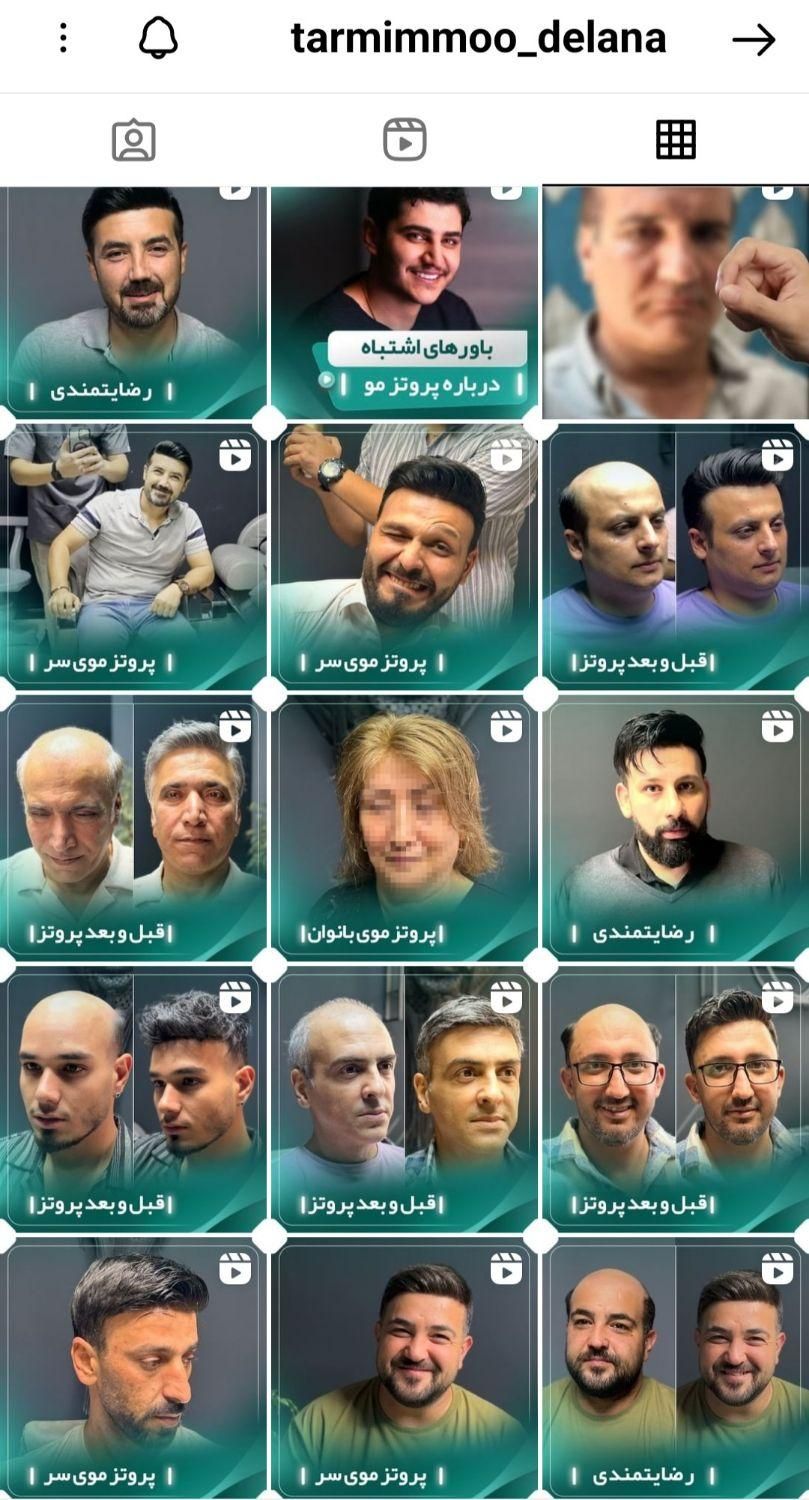 پروتزمو و ترمیم مو و تعمیرات و فروش|آرایشی، بهداشتی، درمانی|تهران, تهرانپارس غربی|دیوار