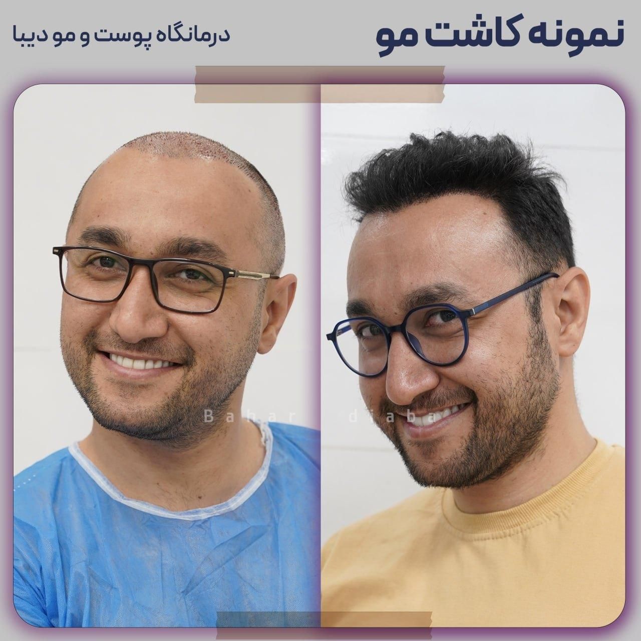(+فیلم) کلینیک کاشت مو، ابرو و ریش|خدمات آرایشگری و زیبایی|تهران, صادقیه|دیوار