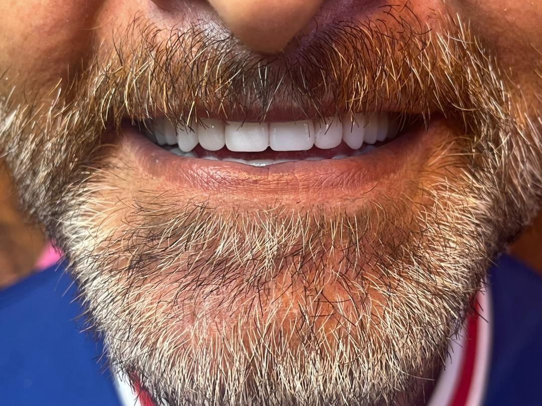 دندانپزشکی و کامپوزیت دندان و دندان مصنوعی|خدمات آرایشگری و زیبایی|تهران, بهداشت|دیوار