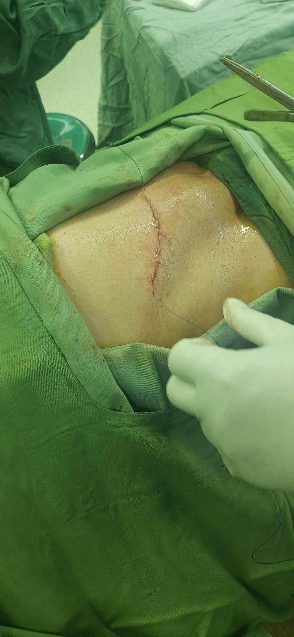 تزریقات،پانسمان و خدمات پرستاری توسط خانم وآقا|خدمات آرایشگری و زیبایی|قرچک, میرزائی شمالی|دیوار