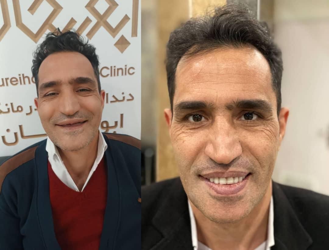 ارائه کلیه خدمات دندانپزشکی تا 24 ماه|خدمات آرایشگری و زیبایی|قم, حنیف نژاد|دیوار