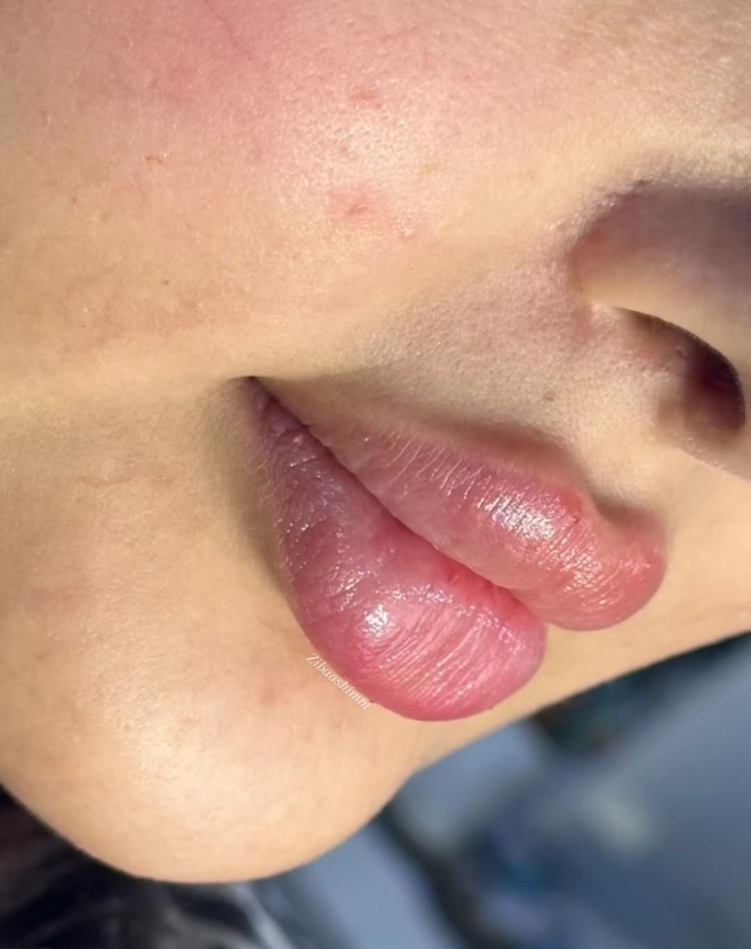 خدمات زیبایی هر سی سی فیلر ۸۵۰|خدمات آرایشگری و زیبایی|اصفهان, تیران|دیوار