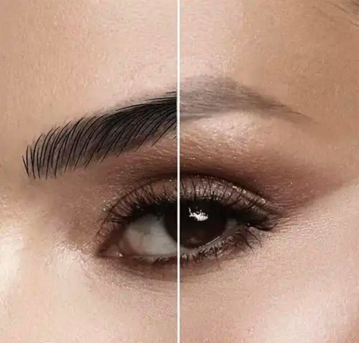لیزر موهای زائد/ریمو تتو/لاغری/ژل/بوتاکس|خدمات آرایشگری و زیبایی|تهران, سعادت‌آباد|دیوار