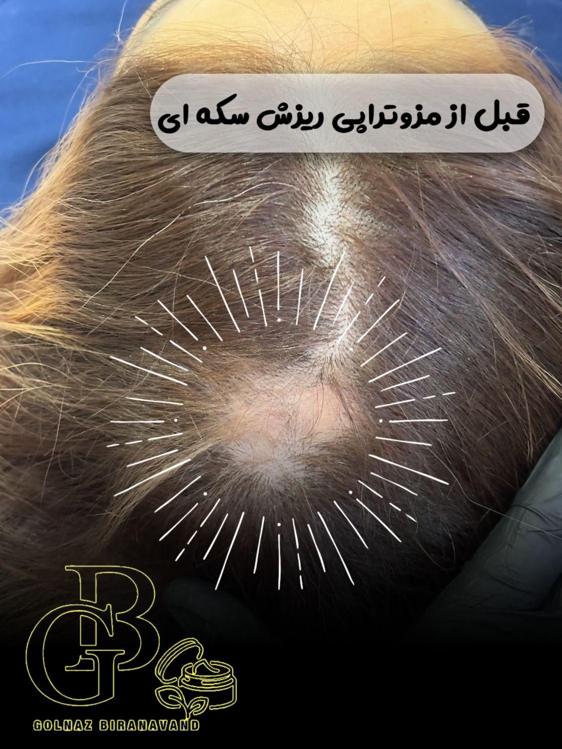 فیشیال.کربن.لیزر.لاغری.هایفو|خدمات آرایشگری و زیبایی|کرج, کوی زنبق|دیوار