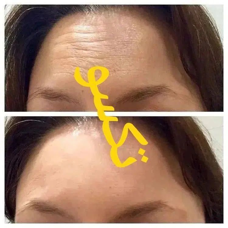 رفع تیرگی ، ناباروری،  چاقی صورت و بدن ، لاغری|آرایشی، بهداشتی، درمانی|زاهدان, |دیوار