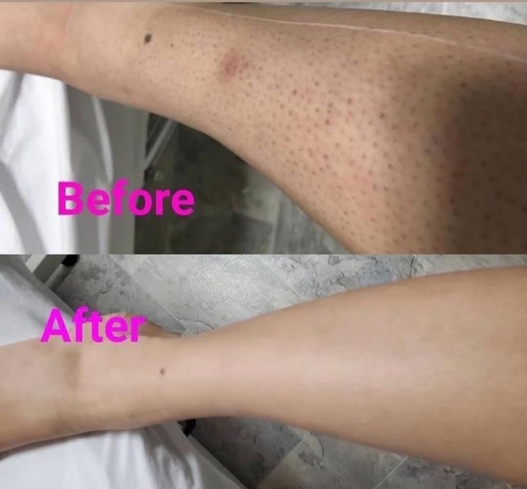 لیزرموهای زائد*ویژه بانوان رایگان|خدمات آرایشگری و زیبایی|اصفهان, بوستان آینه خانه|دیوار