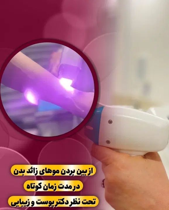لیزر موهای زائد|خدمات آرایشگری و زیبایی|مشهد, هدایت|دیوار