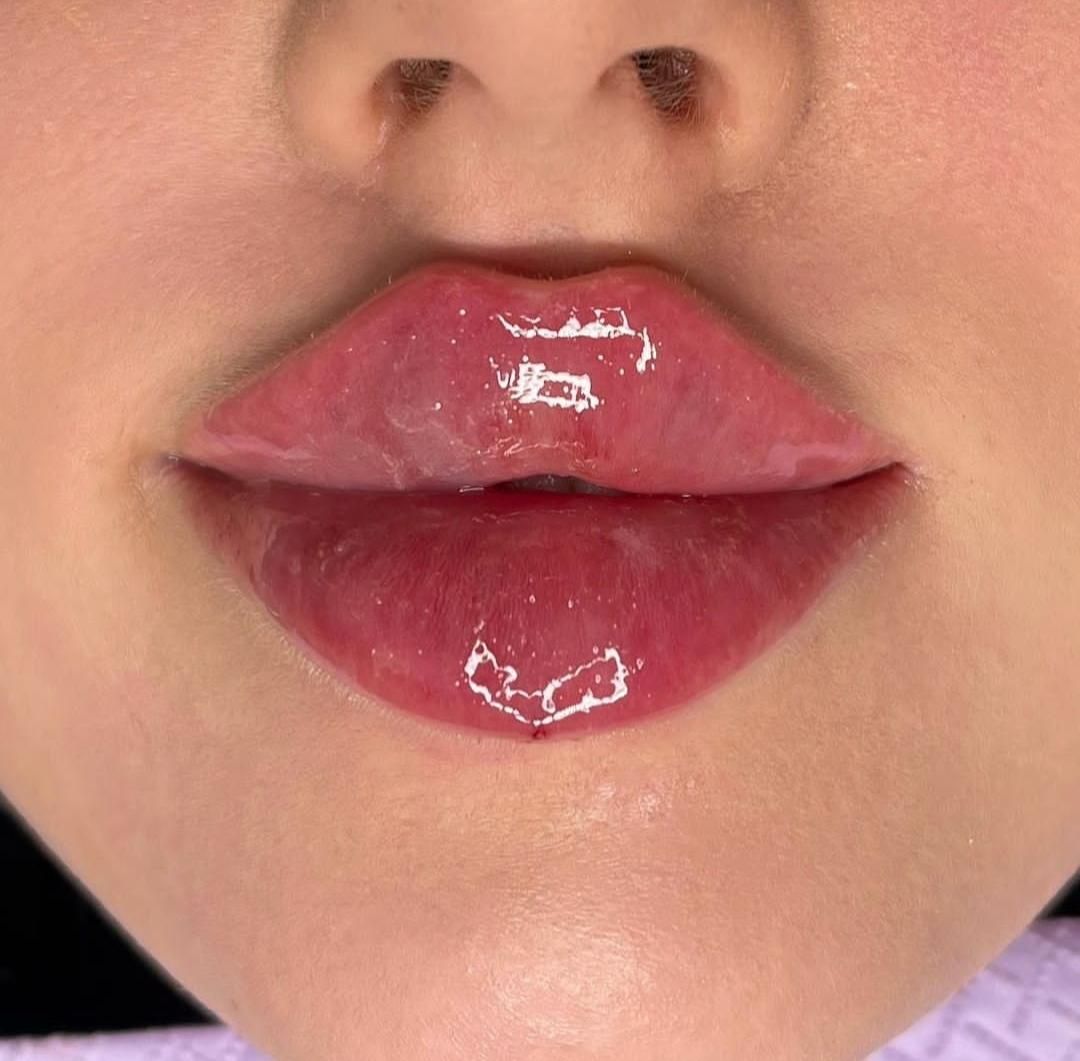 تزریق ژل فیلر بوتاکس مزو و لیزر در کلینیک زیبایی|خدمات آرایشگری و زیبایی|رباطکریم, رباطکریم|دیوار