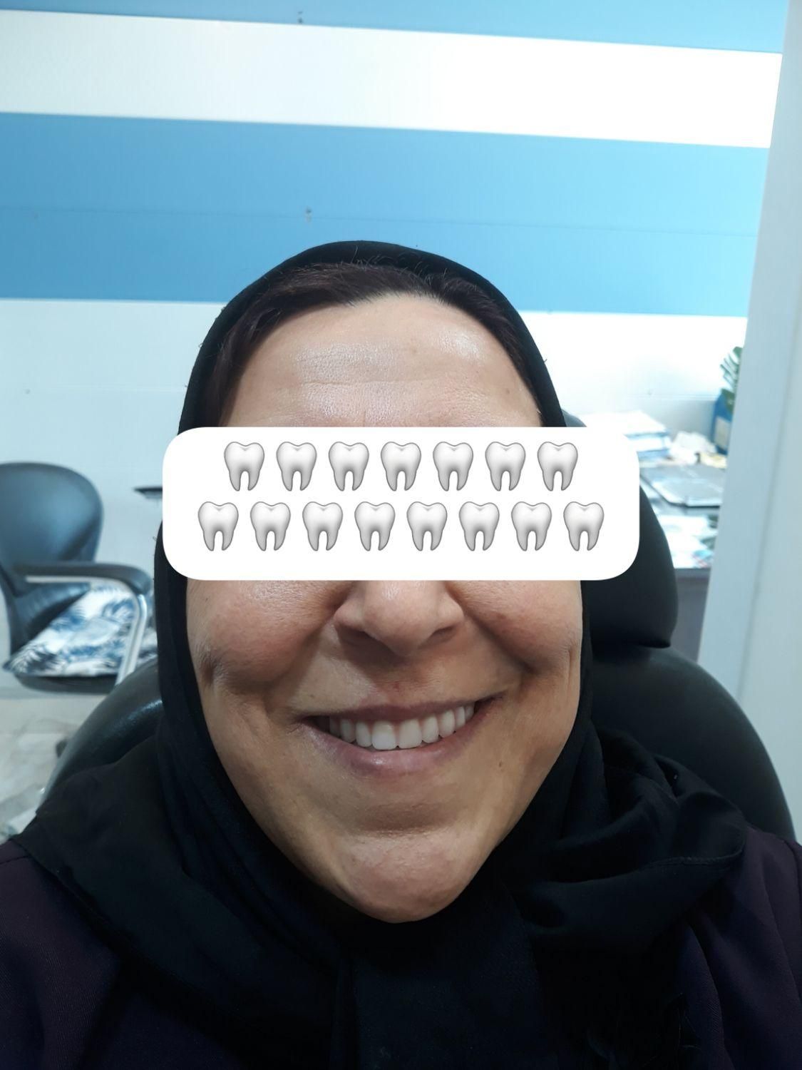 دندانسازی رستمی|خدمات آرایشگری و زیبایی|زنجان, |دیوار