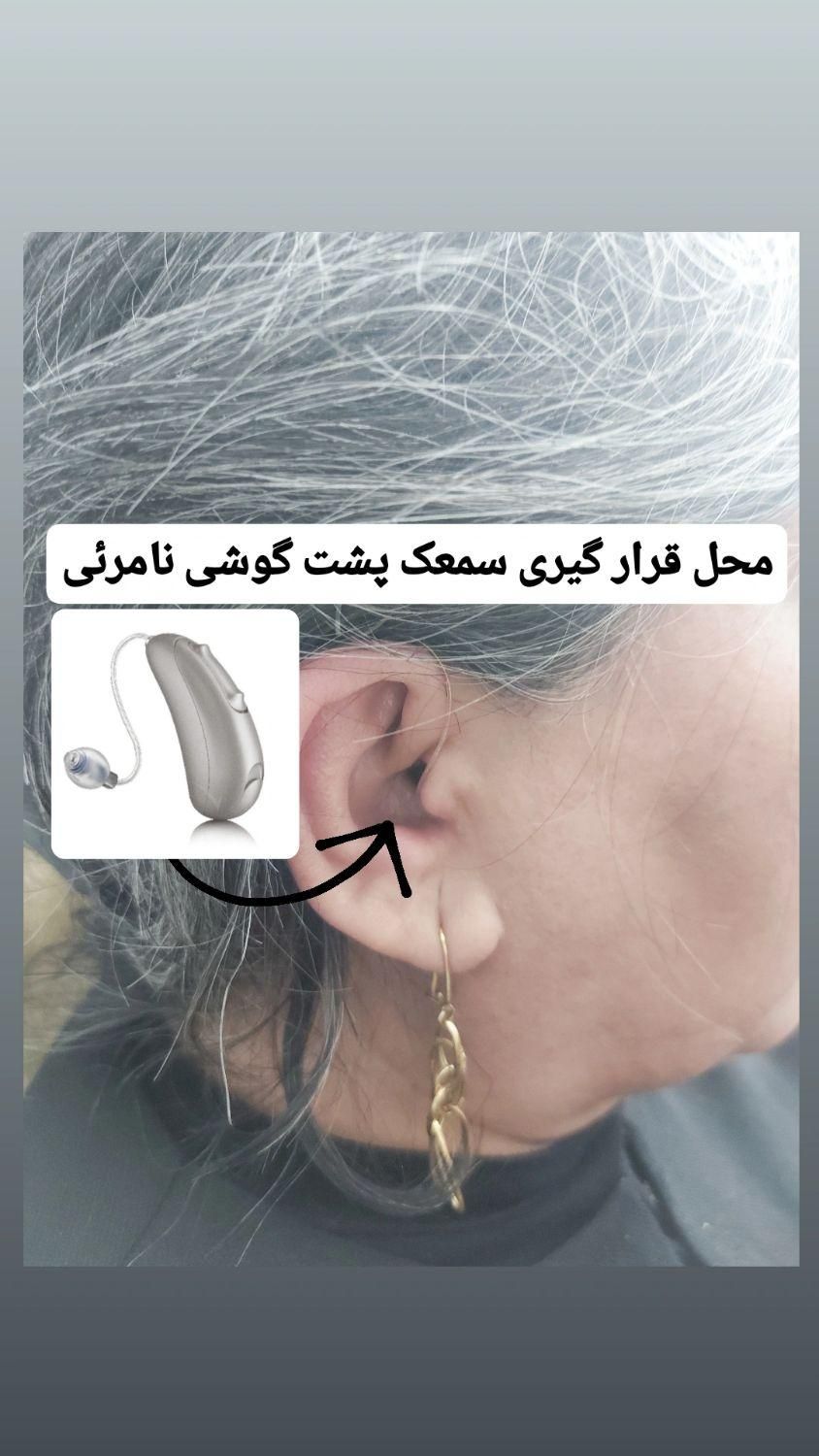 تجویز تخصصی سمعک هوشمند با گارانتی،  نقد و اقساط|خدمات آرایشگری و زیبایی|پرند, فاز ۲|دیوار