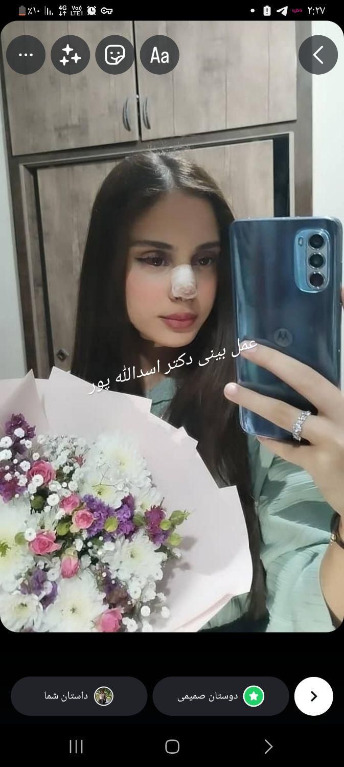 عمل زیبای بینی|خدمات آرایشگری و زیبایی|قائم‌شهر, |دیوار