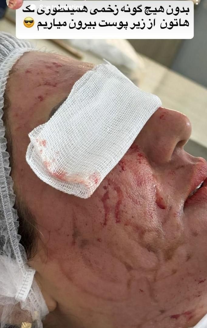 اولین درمانگرلک با متدپکینگ آپ وحذف تک جلسه کک مک|خدمات آرایشگری و زیبایی|بوشهر, |دیوار