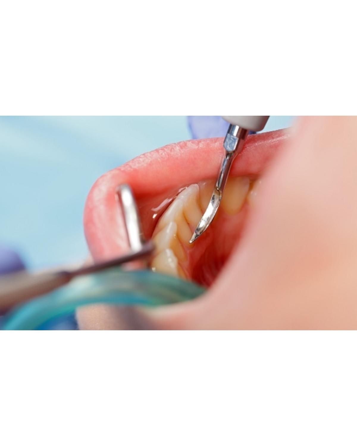 خدمات دندانپزشکی با کیفیت|خدمات آرایشگری و زیبایی|رشت, استادسرا|دیوار
