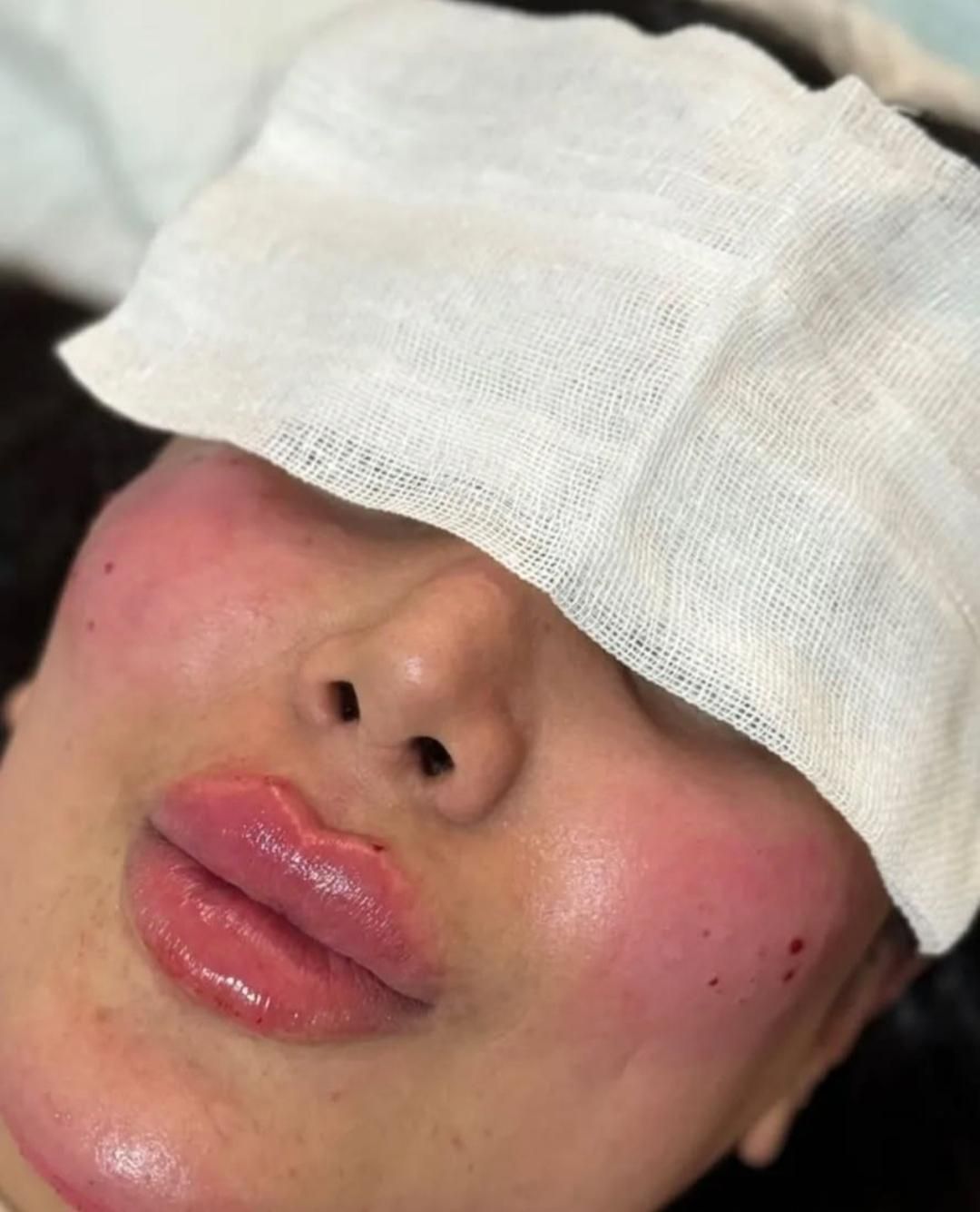 جشنواره ویژه ژل و بوتاکس|خدمات آرایشگری و زیبایی|اردبیل, |دیوار