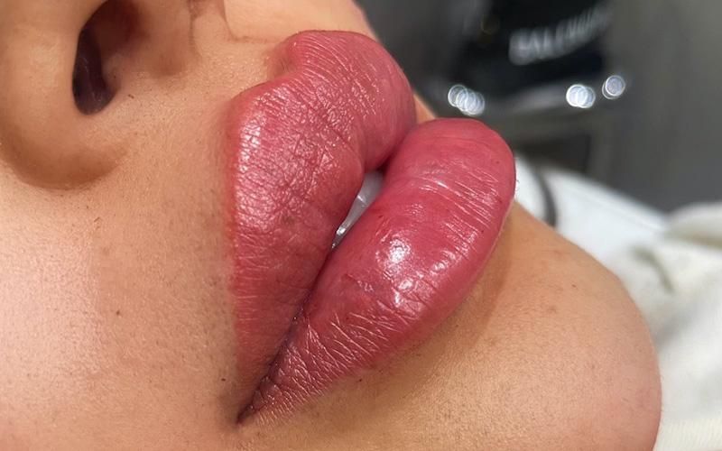 بلفاروپلاستی و رفع پف چشم ، لیفت شقیقه .جراح متخصص|خدمات آرایشگری و زیبایی|اردبیل, |دیوار