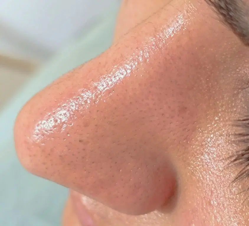 فشیال تخصصی+ اصلاح با بند + درماپلینگ + ابرو  ۳۵۰|خدمات آرایشگری و زیبایی|زاهدان, |دیوار
