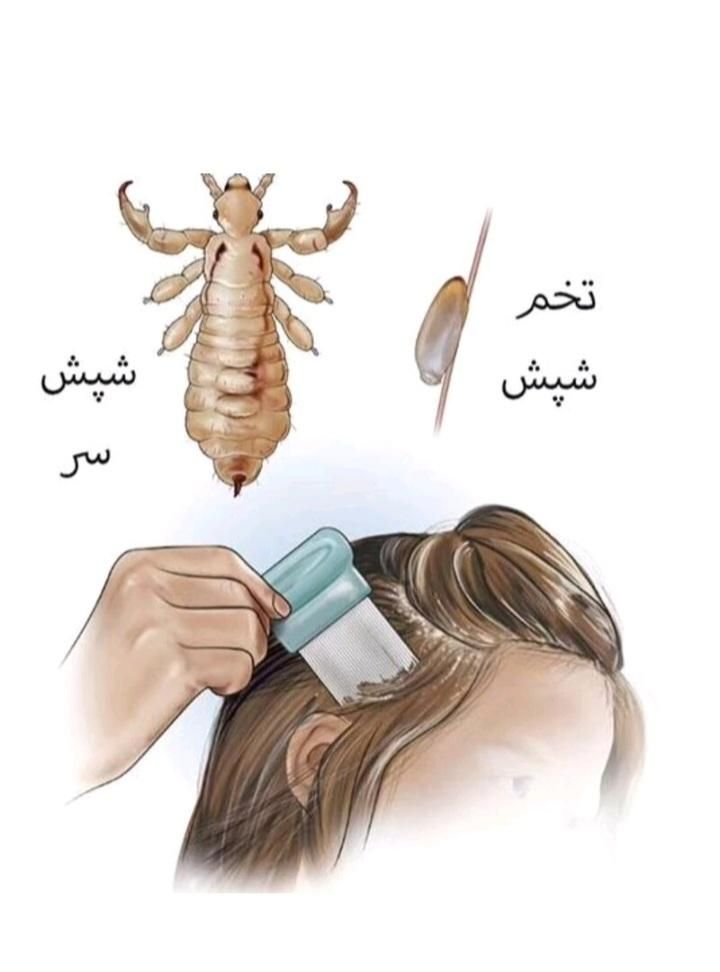 درمان کامل شپش تظمینی|آرایشی، بهداشتی، درمانی|پارس‌آباد, |دیوار