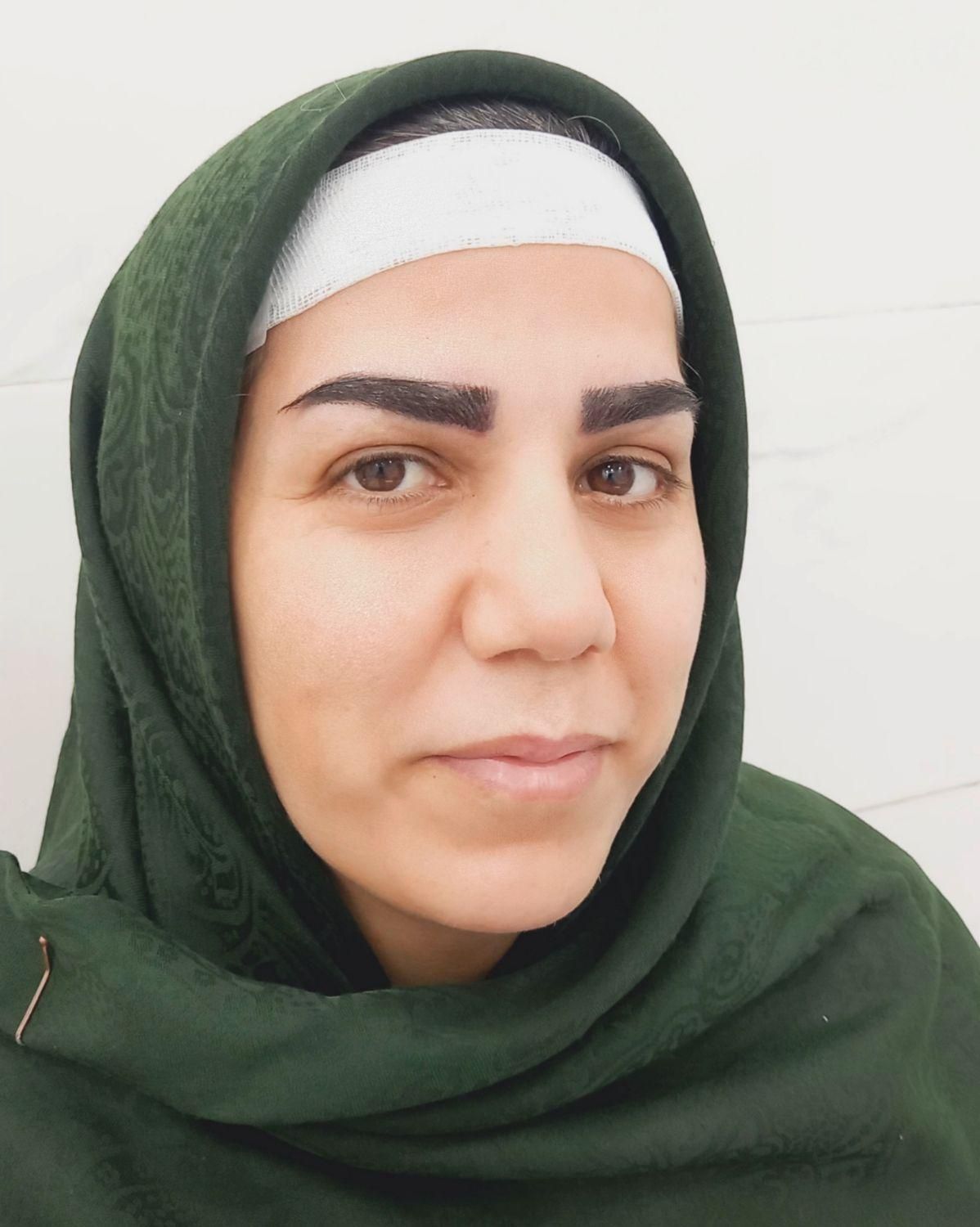 کاشت دائمی ابرو رشت|خدمات آرایشگری و زیبایی|رشت, گلسار|دیوار