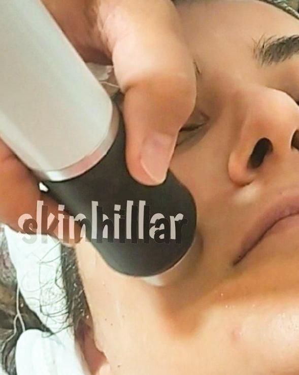 اموزش وخدمات پاکسازی پوست آقاخانوم(تخفیف)ویال مو|خدمات آرایشگری و زیبایی|گرگان, |دیوار
