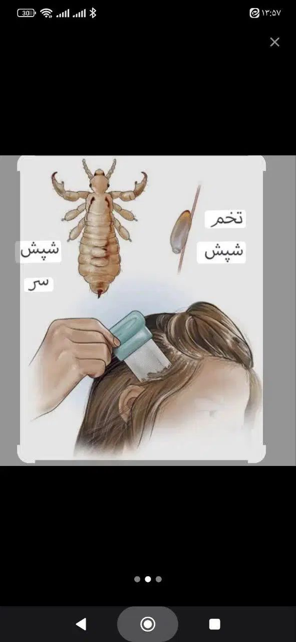 محلول گیاهی برای درمان شپش و رشک سر بدون عوارض|آرایشی، بهداشتی، درمانی|سبزوار, کاشفی شمالی (دادگستری)|دیوار